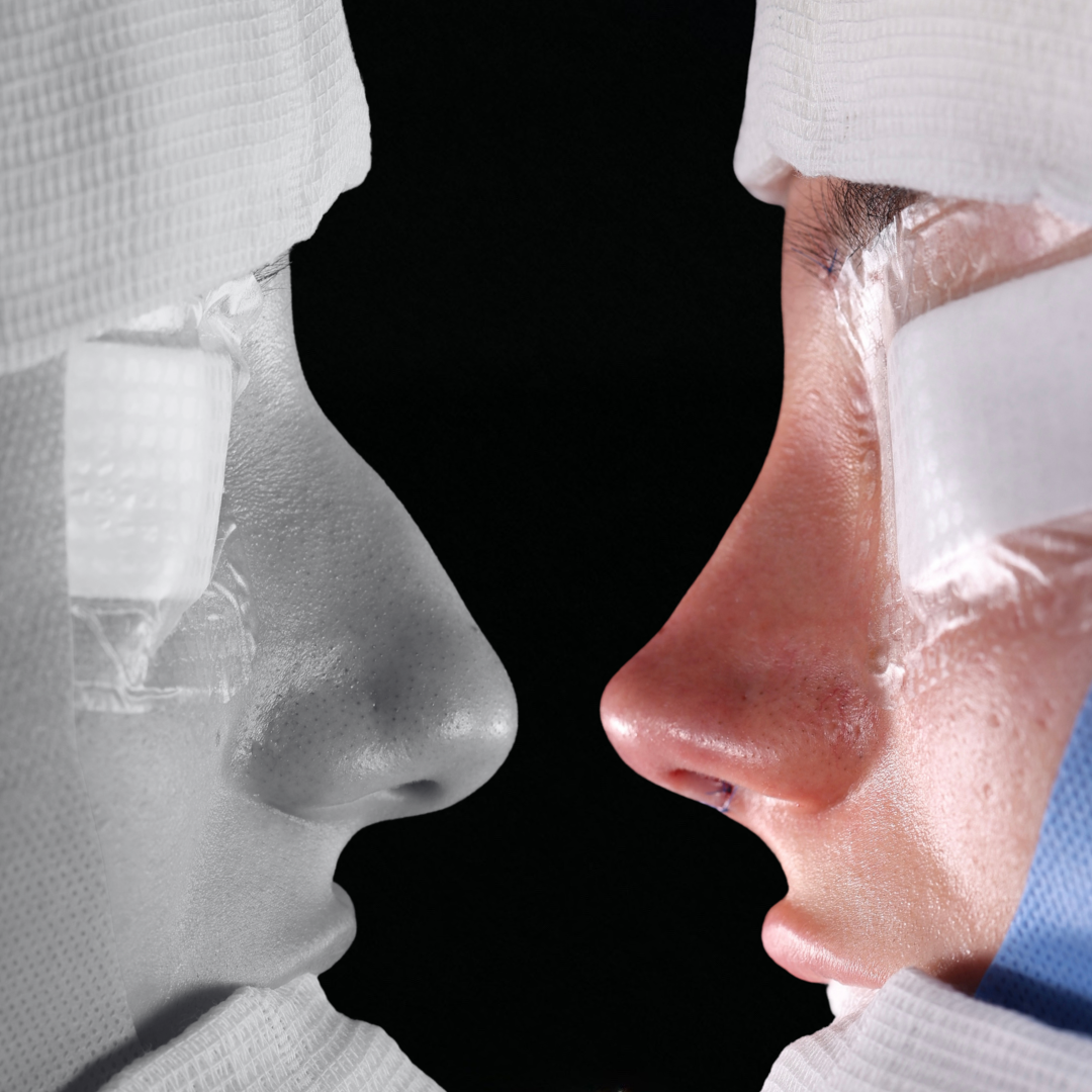 Cópia de Capa reels - 1