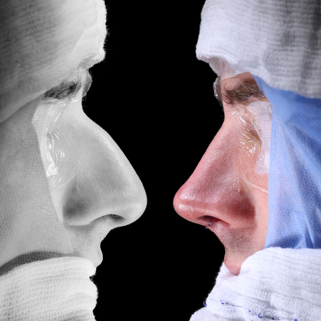 Cópia de Capa reels - 11