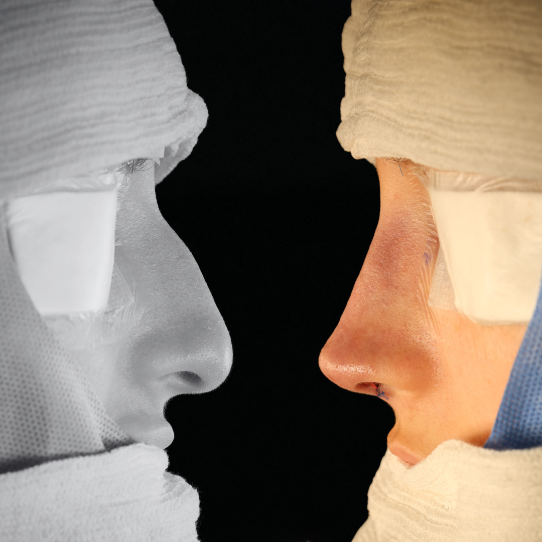 Cópia de Capa reels - 12