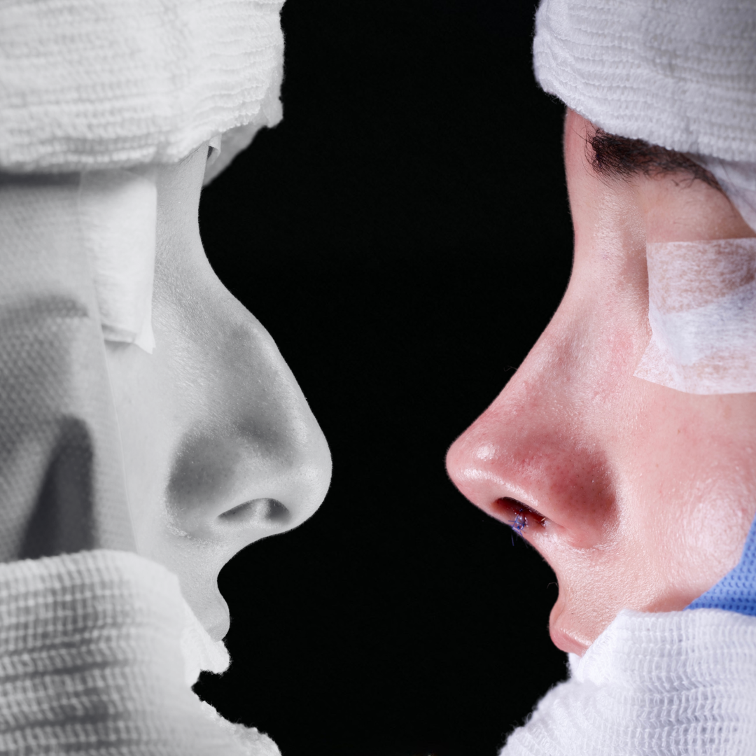 Cópia de Capa reels - 13