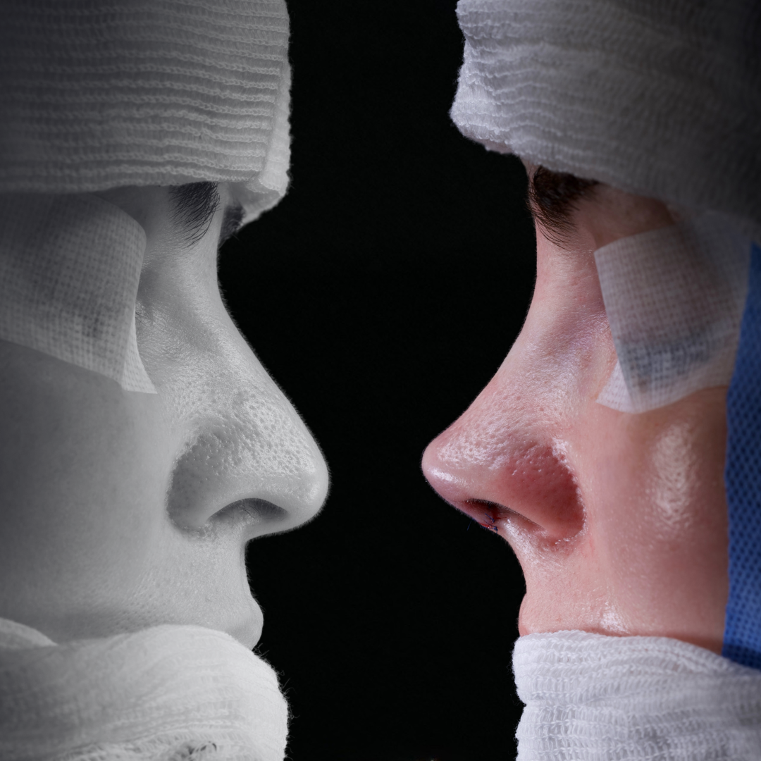 Cópia de Capa reels - 14