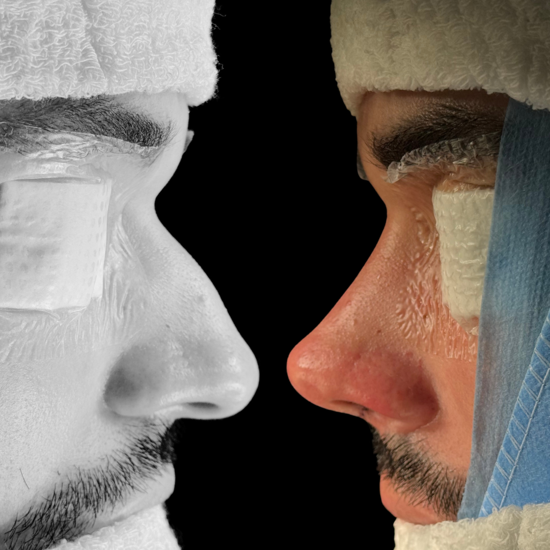 Cópia de Capa reels - 15