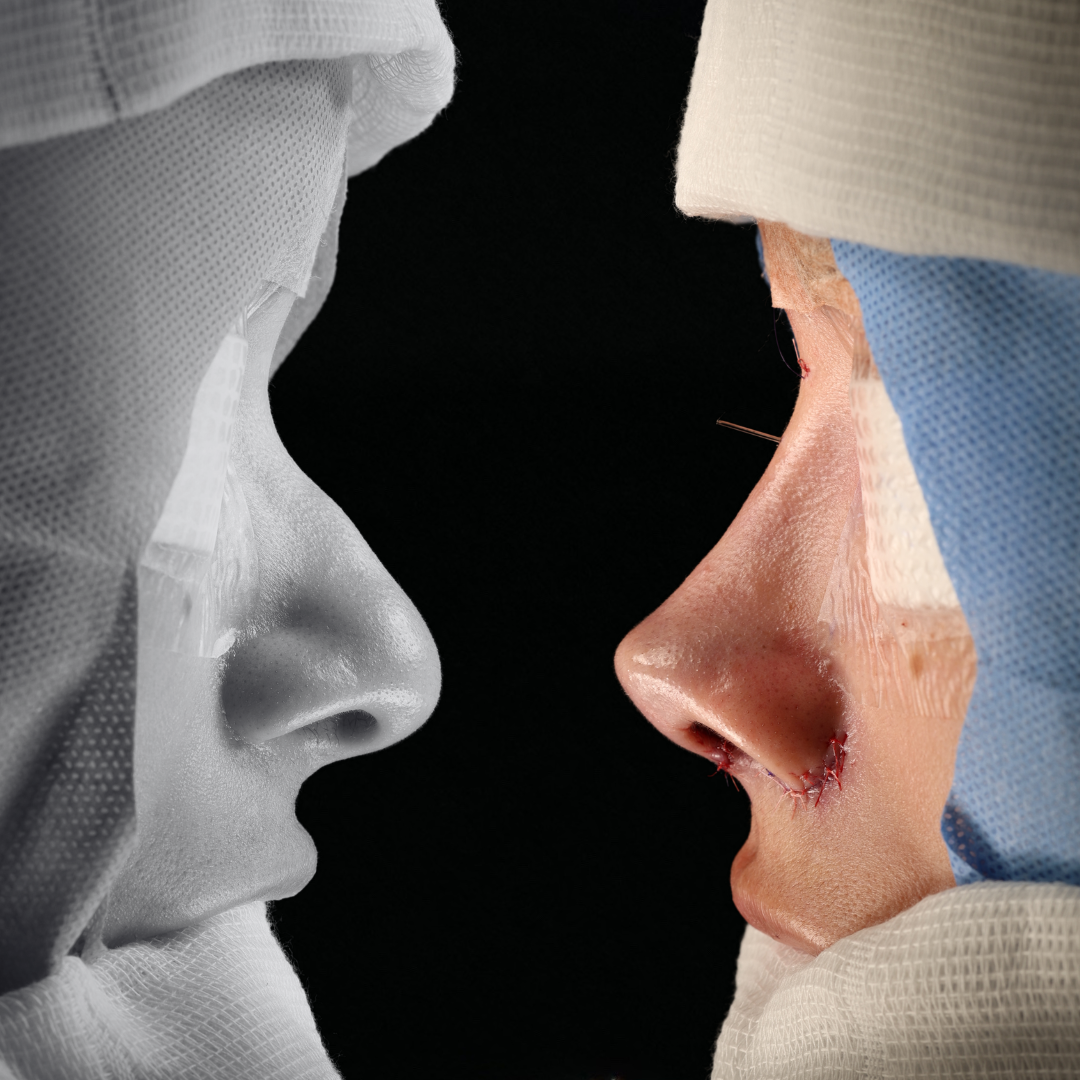 Cópia de Capa reels - 16