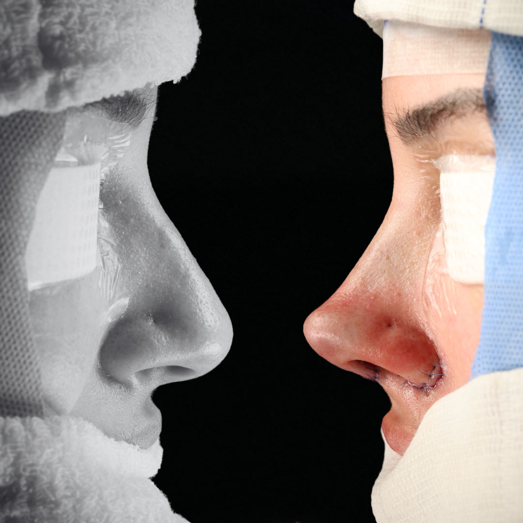 Cópia de Capa reels - 17