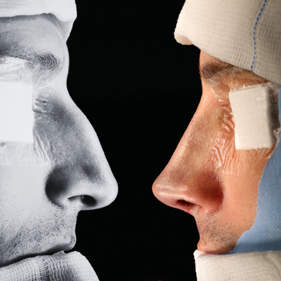 Cópia de Capa reels - 18