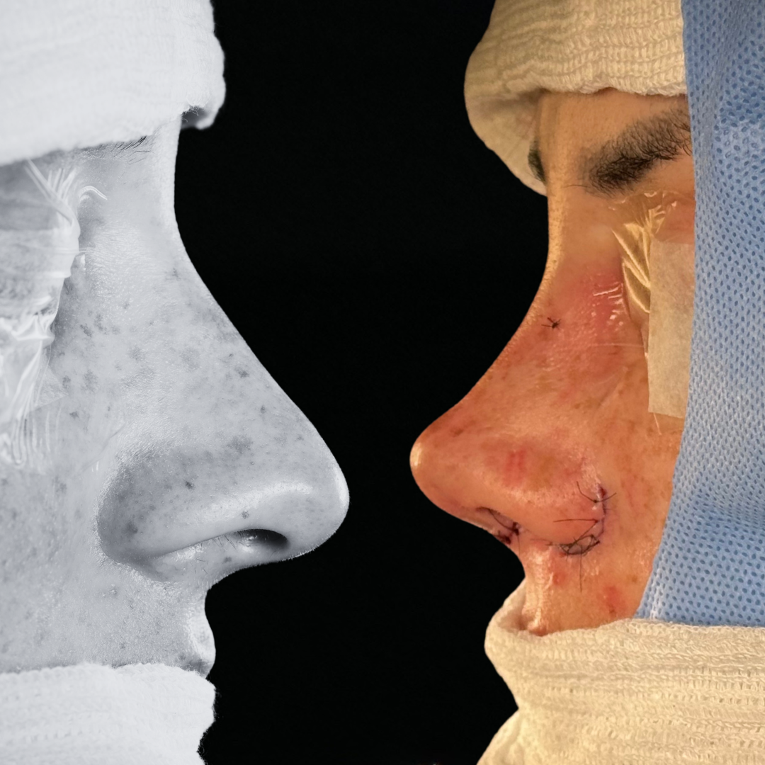 Cópia de Capa reels - 19