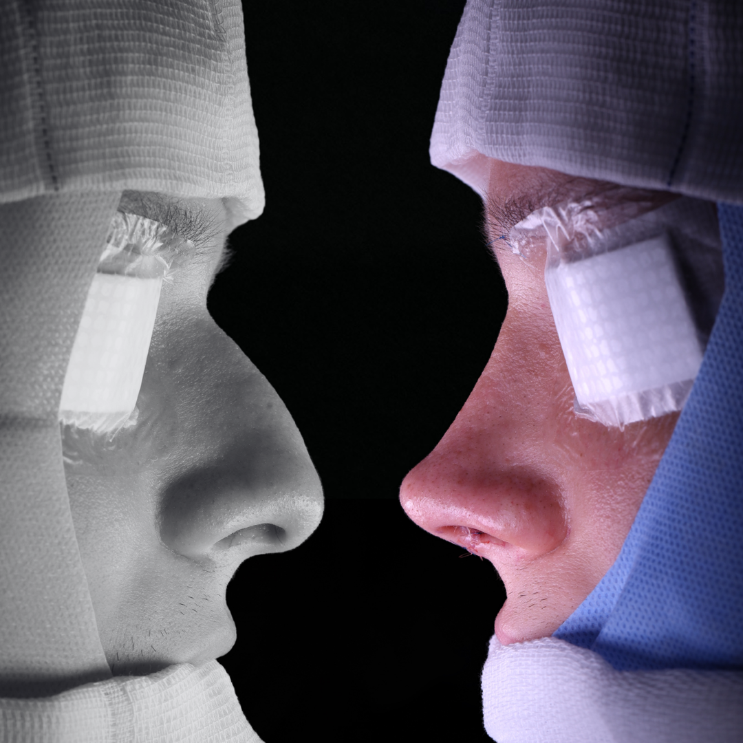 Cópia de Capa reels - 2