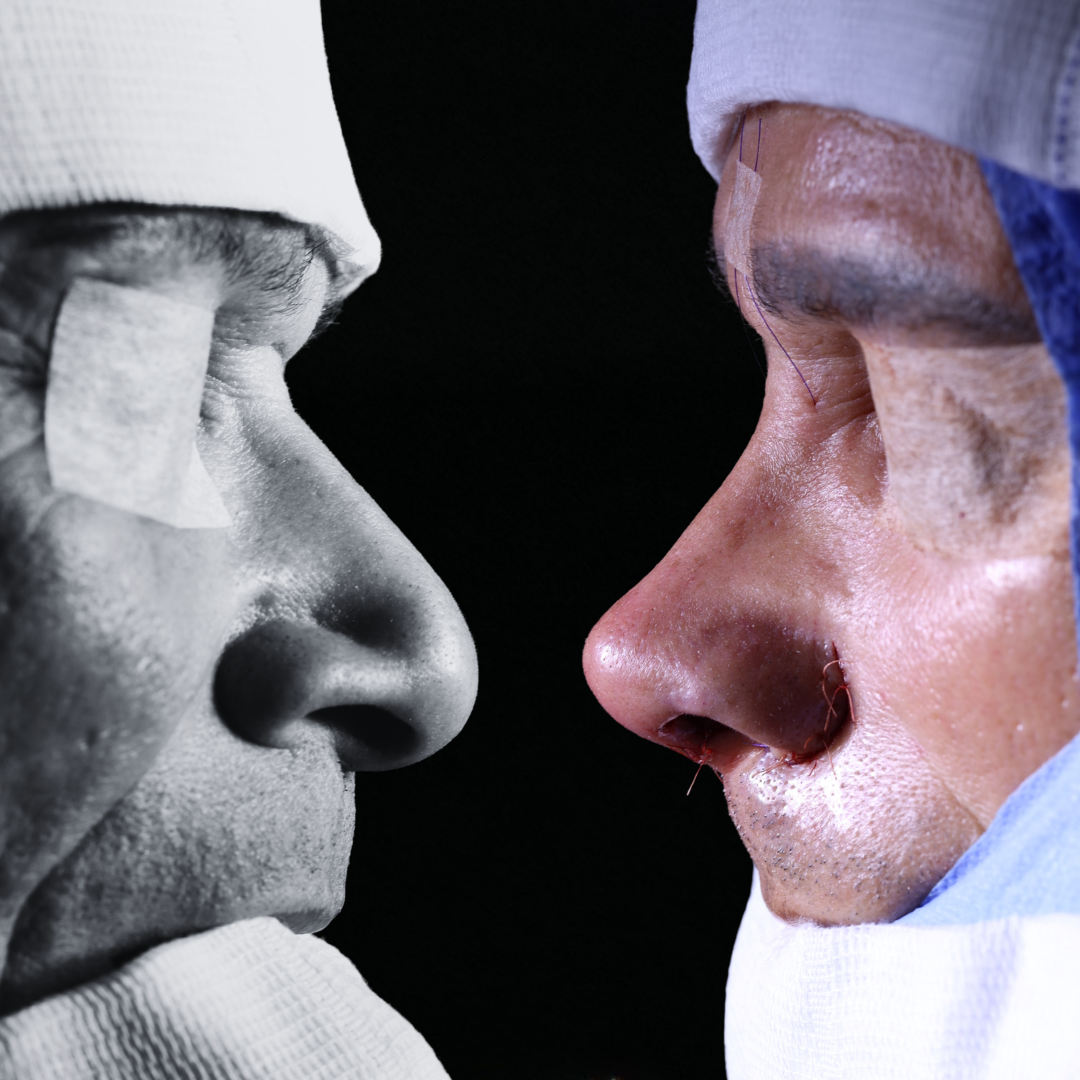 Cópia de Capa reels - 20