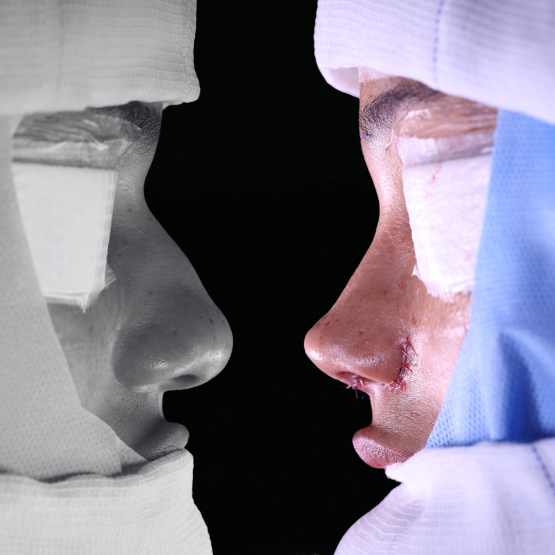 Cópia de Capa reels - 4