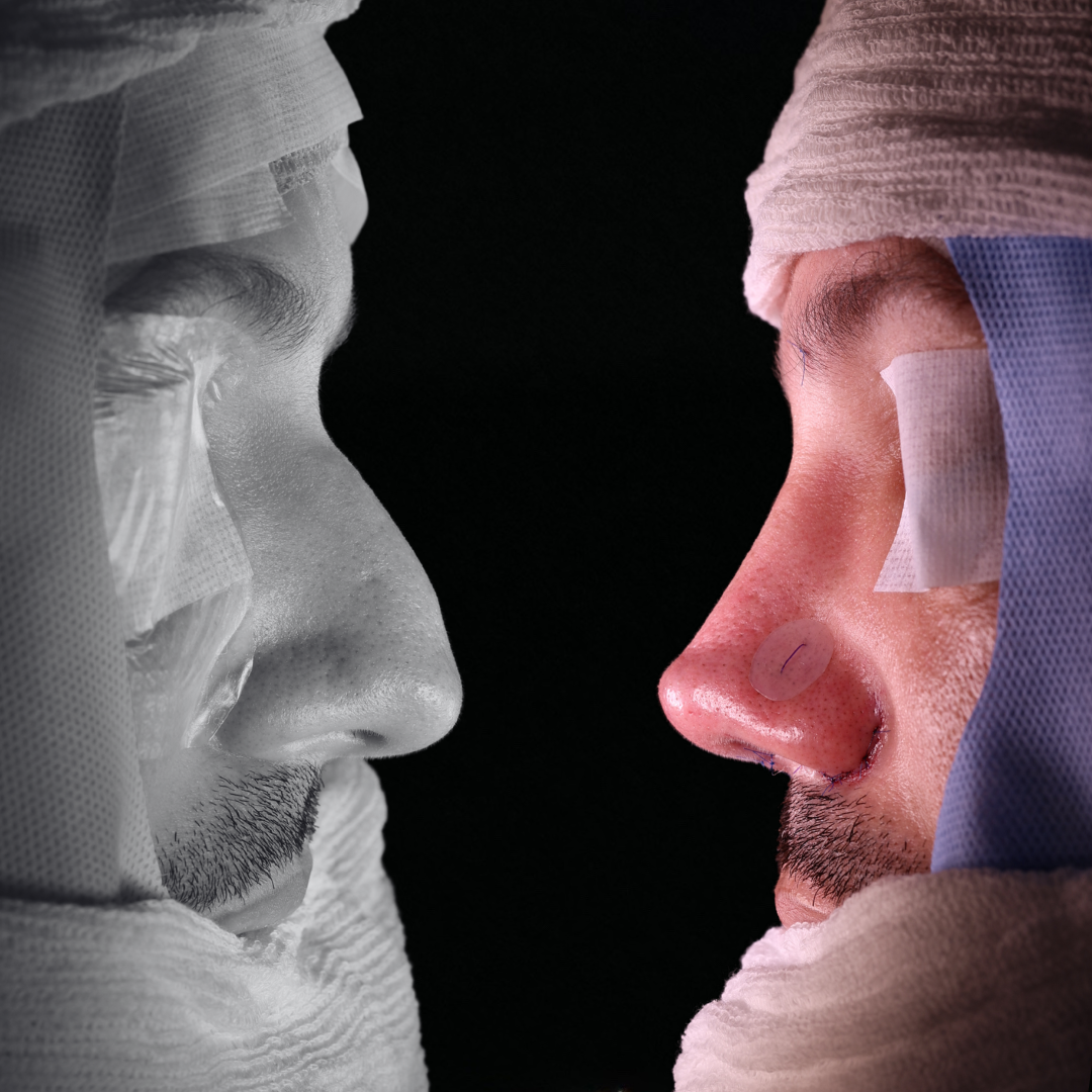 Cópia de Capa reels - 5