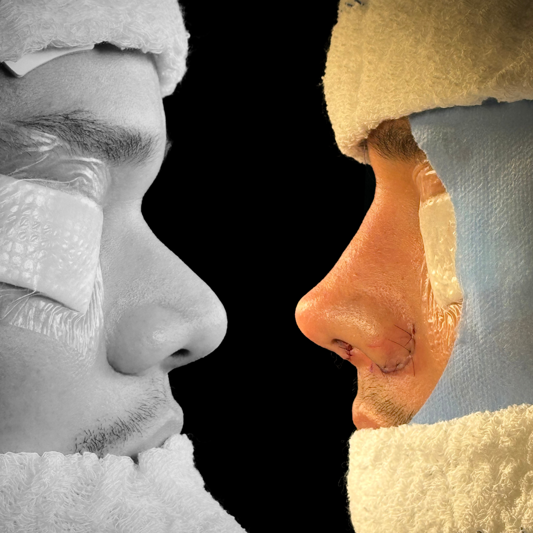 Cópia de Capa reels - 7